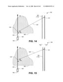 Compton scattered x-ray visualizing, imaging, or information providing of at least some dissimilar matter diagram and image