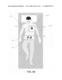 Limiting ablation based at least partially on Compton scattered X-ray visualizing, imaging, or information providing diagram and image