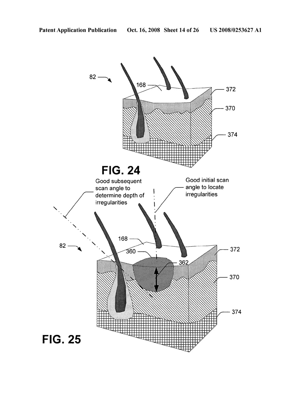 Compton scattered X-ray visualization, imaging, or information provider using image combining - diagram, schematic, and image 15