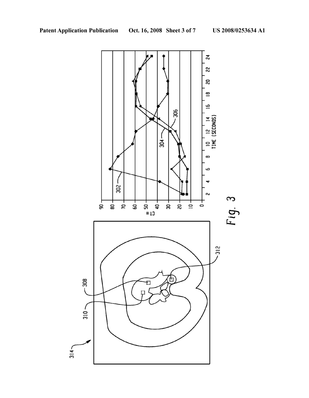 Method and Apparatus for Predicting Enhancement in Angiography - diagram, schematic, and image 04