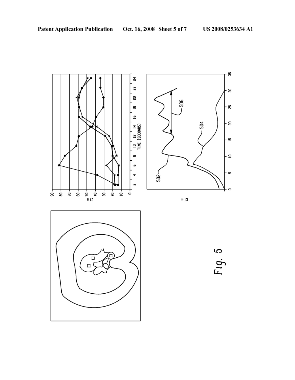 Method and Apparatus for Predicting Enhancement in Angiography - diagram, schematic, and image 06