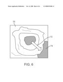 Method and Device for Examining or Imaging an Interior Surface of a Cavity diagram and image