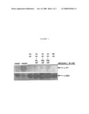 COMBINATIONS FOR THE TREATMENT OF DISEASES INVOLVING CELL PROLIFERATION, MIGRATION OR APOPTOSIS OF MYELOMA CELLS OR ANGIOGENESIS diagram and image