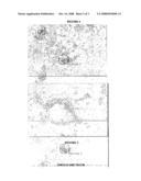 Porcine Islets Cultured With Porcine Sertoli Cells For Xenotransplantation diagram and image