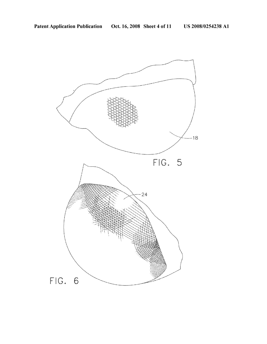 METHOD AND APPARATUS FOR SCALED UP REPRODUCTION OF DETAILED FEATURES - diagram, schematic, and image 05