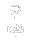 SYSTEM FOR PRODUCING ORTHODONTIC ALIGNERS BY CNC MACHINING diagram and image