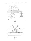 Method and device for improving oral health diagram and image