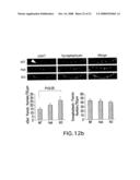 ALTERED ZDHHC8 EXPRESSION AS A MARKER OF INCREASED RISK OF SCHIZOPHRENIA diagram and image