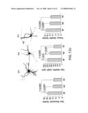 ALTERED ZDHHC8 EXPRESSION AS A MARKER OF INCREASED RISK OF SCHIZOPHRENIA diagram and image