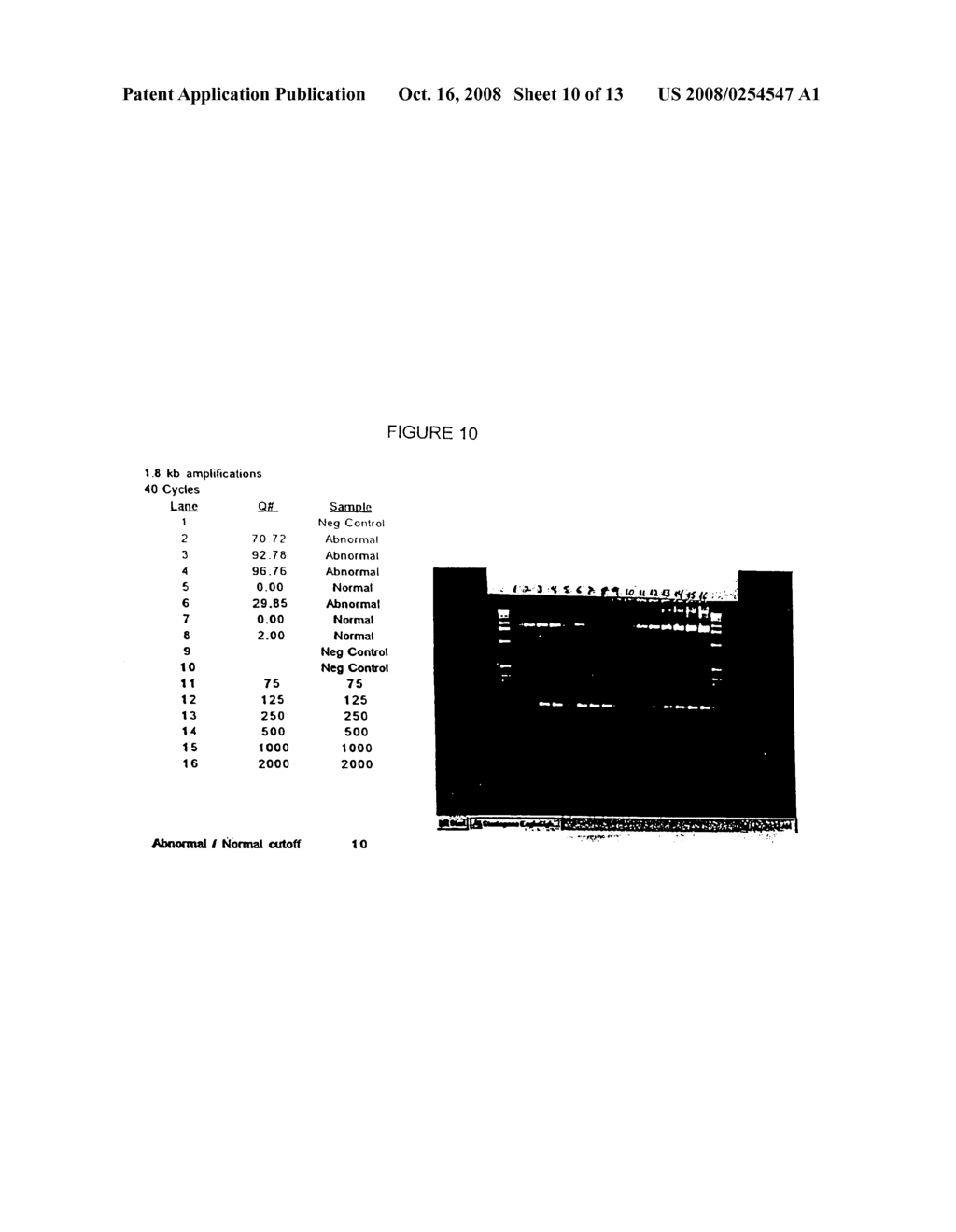 SUPRACOLONIC AERODIGESTIVE NEOPLASM DETECTION - diagram, schematic, and image 11