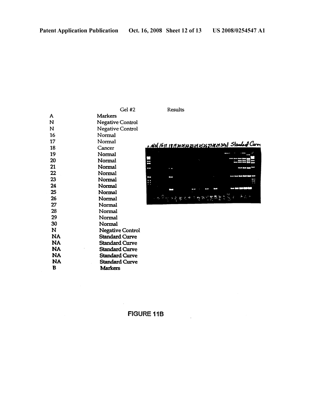 SUPRACOLONIC AERODIGESTIVE NEOPLASM DETECTION - diagram, schematic, and image 13