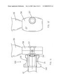 Balloon Inflation Device diagram and image