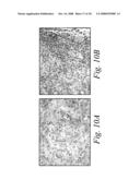 COMPOSITIONS AND METHODS FOR THE TREATMENT OF CANCER diagram and image