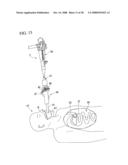 MEDICAL DEVICE diagram and image