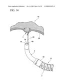 MEDICAL DEVICE diagram and image