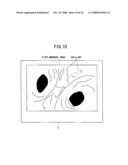 AUTOFLUORESCENCE ENDOSCOPE SYSTEM AND LIGHT-SOURCE UNIT diagram and image