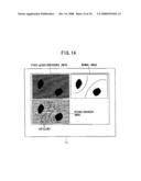 AUTOFLUORESCENCE ENDOSCOPE SYSTEM AND LIGHT-SOURCE UNIT diagram and image