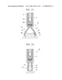  LIGATION APPARATUS AND A LIGATION MEMBER diagram and image