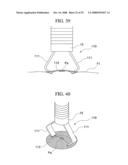  LIGATION APPARATUS AND A LIGATION MEMBER diagram and image