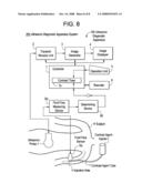 ULTRASONIC DIAGNOSTIC APPARATUS diagram and image