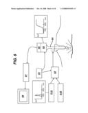 SENTINEL NODE IDENTIFICATION USING FLUORESCENT NANOPARTICLES diagram and image