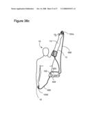 METHOD AND APPARATUS FOR DETERMINING VASCULAR HEALTH CONDITIONS diagram and image