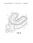 Sensitizer Solutions, Systems, and Methods of Use diagram and image