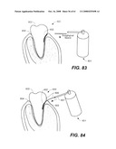 Sensitizer Solutions, Systems, and Methods of Use diagram and image