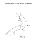 Robotic catheter systems and methods diagram and image