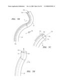Robotic catheter systems and methods diagram and image