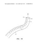 Robotic catheter systems and methods diagram and image