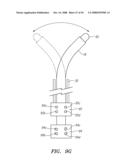 Robotic catheter systems and methods diagram and image