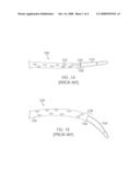 PERCUTANEOUS ACCESS SYSTEM diagram and image