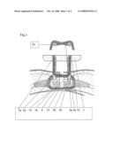 External Fixator for Osteosynthesis or Bone Gap Manipulation diagram and image