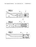 Fracture Fixation and Site Stabilization System diagram and image