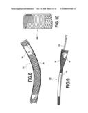 Fracture Fixation and Site Stabilization System diagram and image