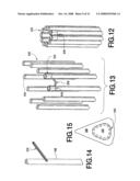 Fracture Fixation and Site Stabilization System diagram and image