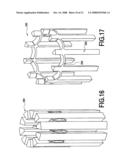 Fracture Fixation and Site Stabilization System diagram and image