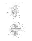 ANCILLARY TOOL AND METHOD FOR POSITIONING A PROSTHETIC ACETABULUM OF A HIP PROSTHESIS diagram and image