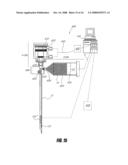 BONE TREATMENT SYSTEMS AND METHODS diagram and image