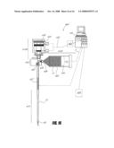 BONE TREATMENT SYSTEMS AND METHODS diagram and image