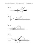 SHORT SLEEVE STENT DELIVERY CATHETER AND METHODS diagram and image