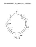 Apparatus and method for minimally invasive suturing diagram and image