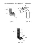Implant Device Particularly Useful For Implantation In the Intravascular System For Diverting Emboli diagram and image