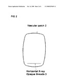 LABELED VASCULAR PATCH diagram and image