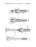 Posterior spinal fixation with colinear facet screw diagram and image