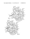 Posterior spinal fixation with colinear facet screw diagram and image