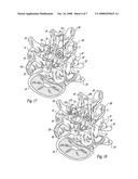 Posterior spinal fixation with colinear facet screw diagram and image