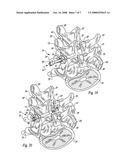 Posterior spinal fixation with colinear facet screw diagram and image