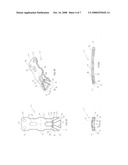 Anterior Vertebral Plate With Spike Fixation diagram and image